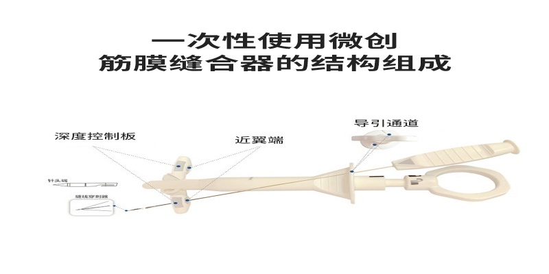 武汉耦合医学一次性微创筋膜缝合器